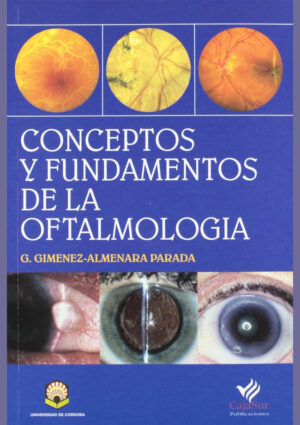 Conceptos y fundamentos de la Oftalmología